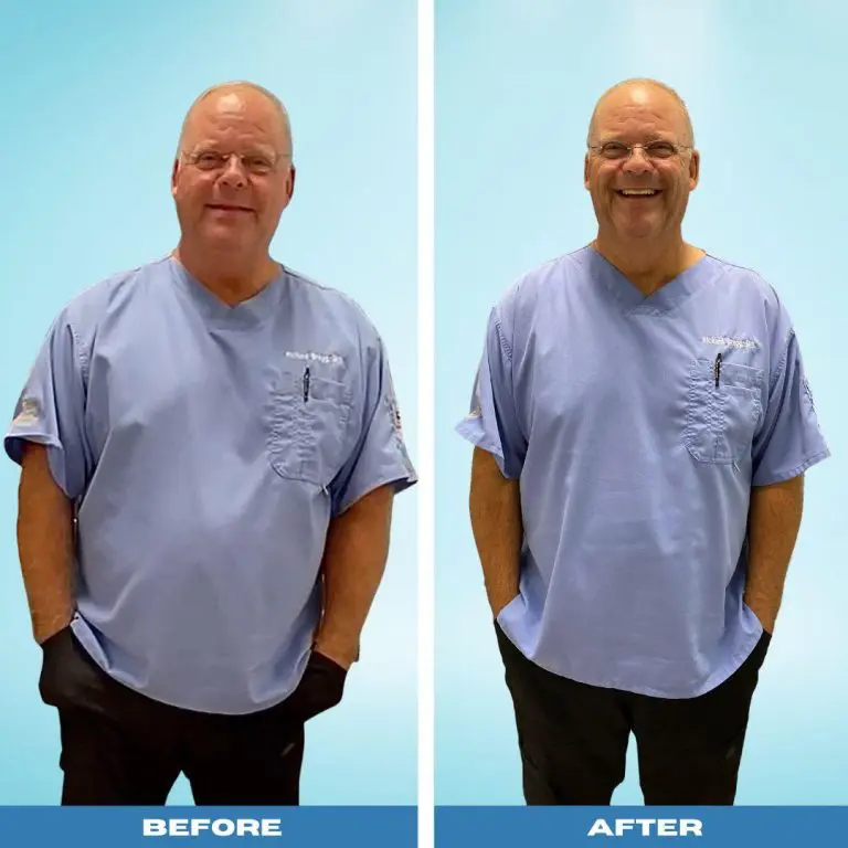 dr brag before and after results