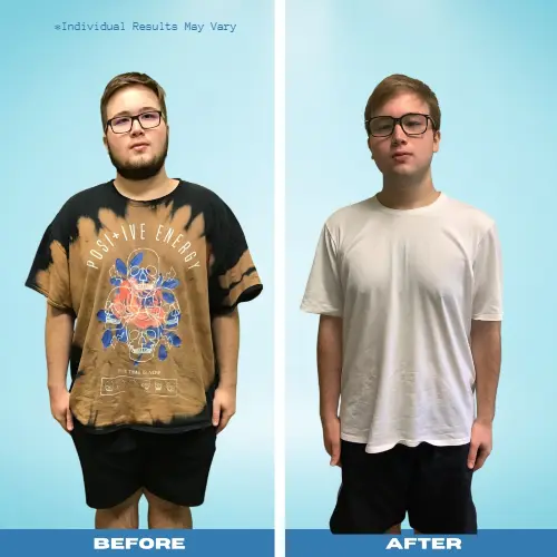 before and after weight loss