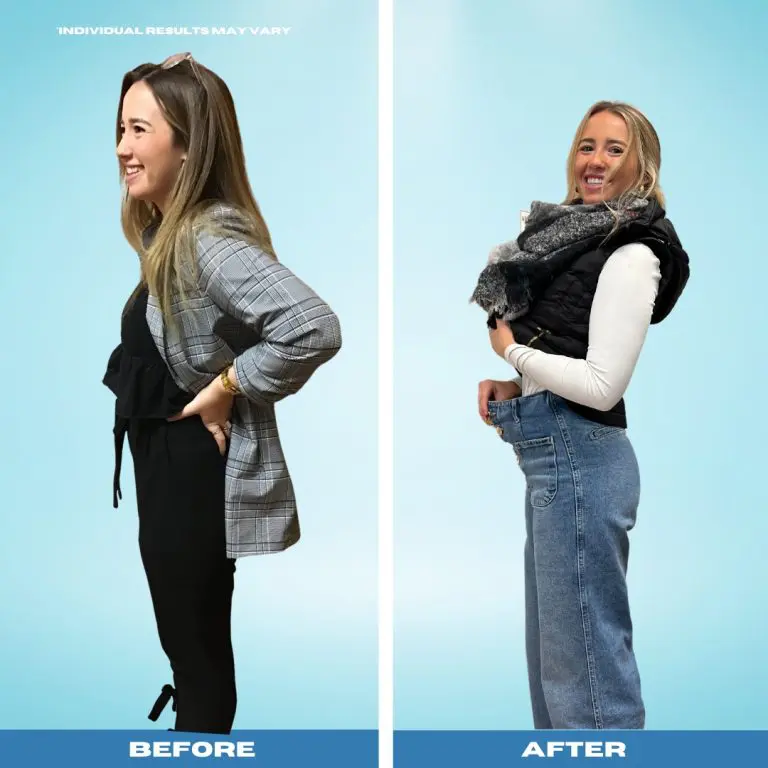 svelte semaglutide before and after