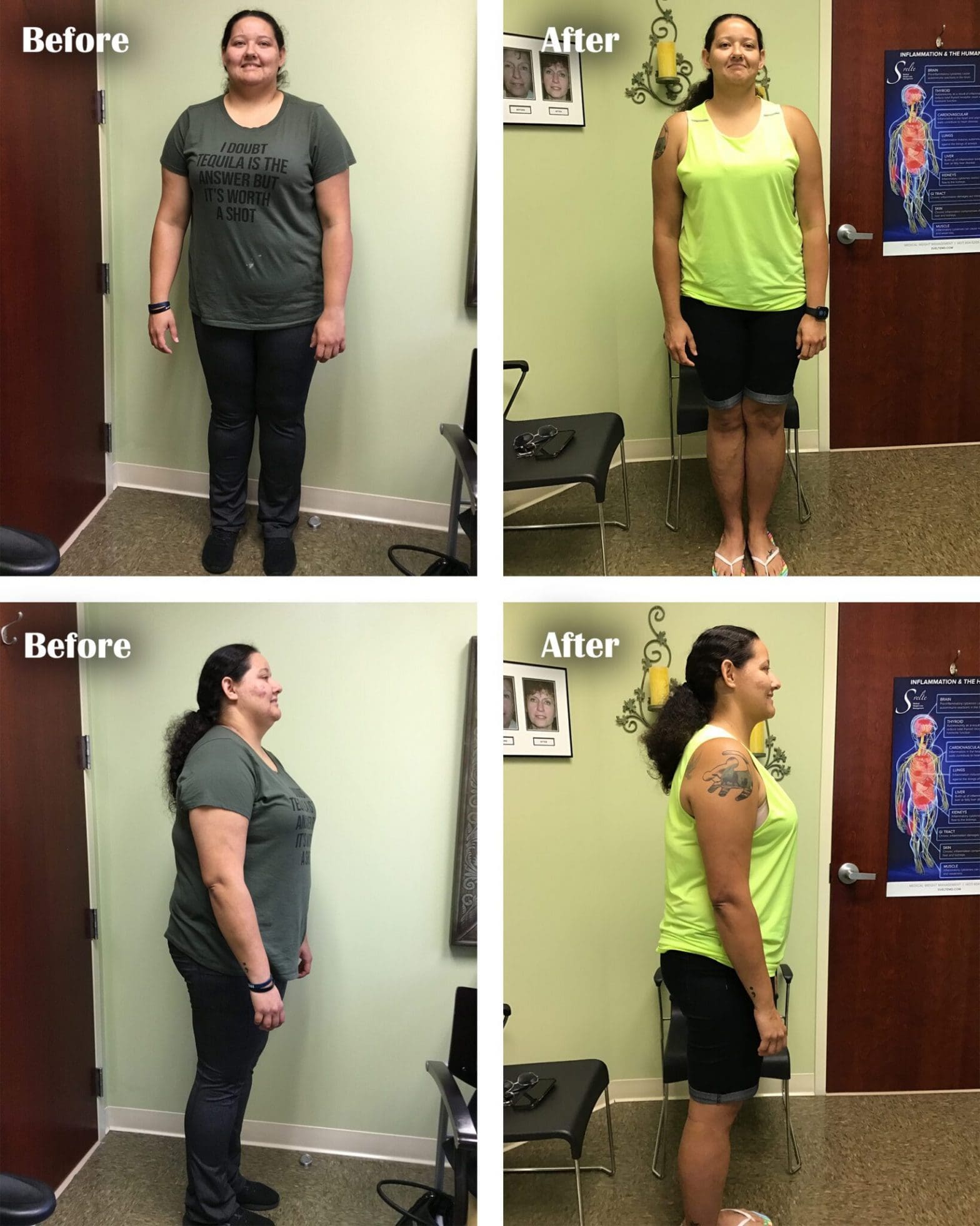 Serotonin Coolsculpting & Weight Loss Center Orlando Weight Loss Clinic Weight Loss Orlando - Svelte Medical Weight Loss Centers