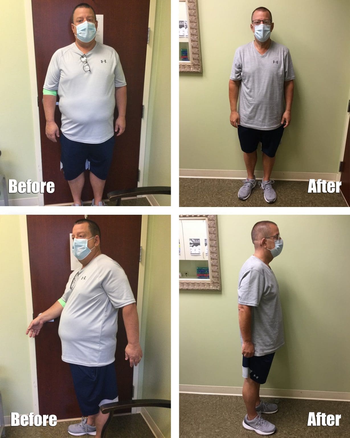 Semaglutide Weight Loss Orlando (407) 8045200