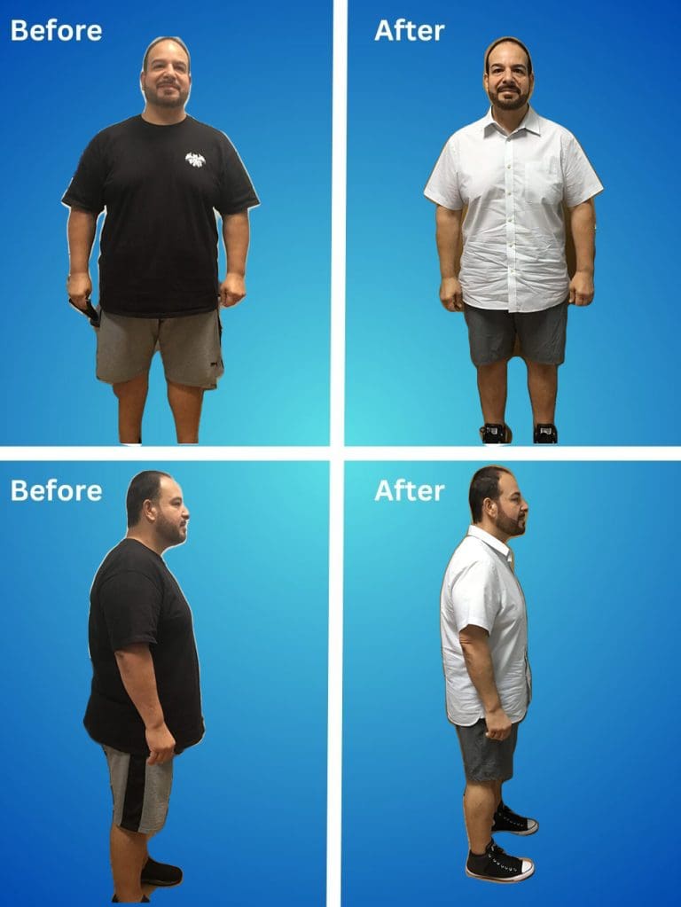 before and after weight loss