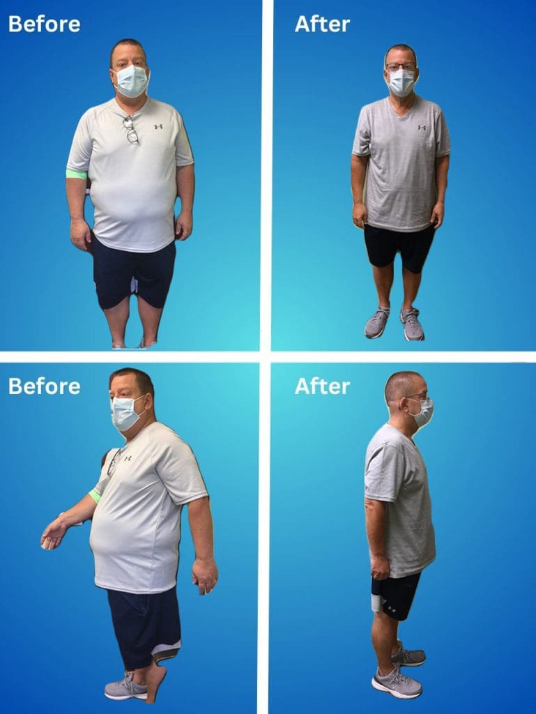 Semaglutide Weight Loss Orlando (407) 8045200