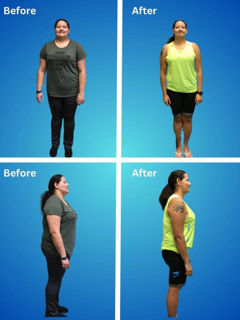 Picture of Semaglutide for Weight Loss in Orlando