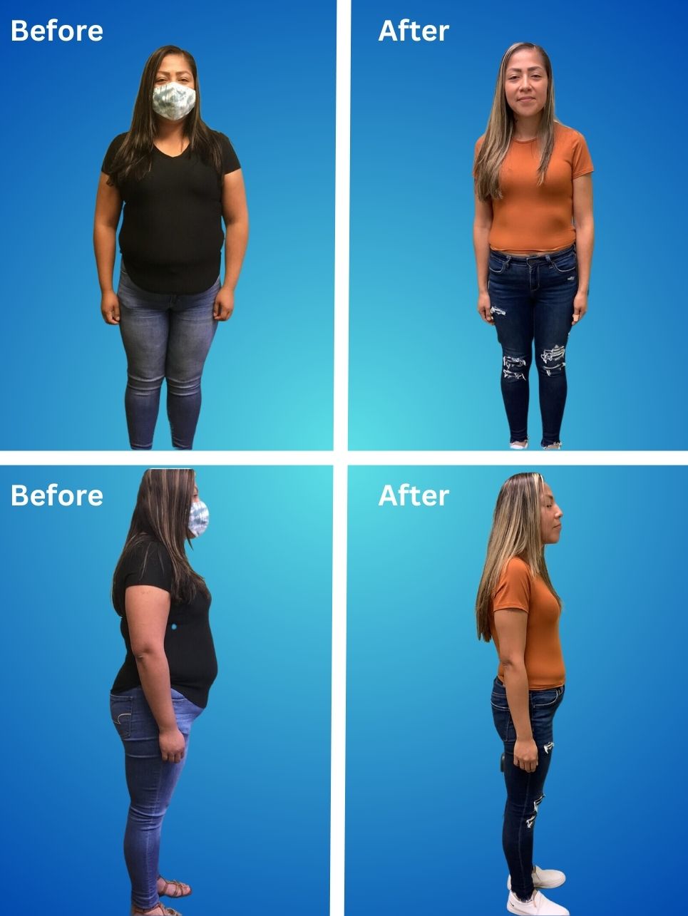 before and after weight loss